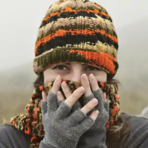 Pelle secca e screpolata in inverno: come curarla naturalmente per averla sana e morbida