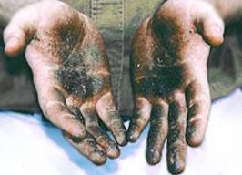 Sfregamento delle mani