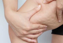 Cellulite rimedi naturali per combatterla