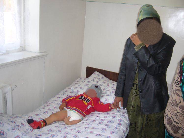 Bambino con arti deformati in Uzbekistan
