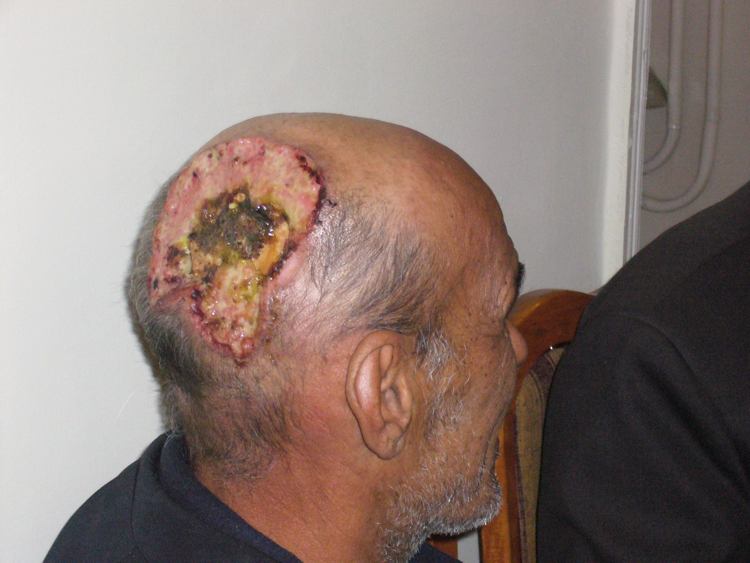 Uomo con testa deformata in Uzbekistan